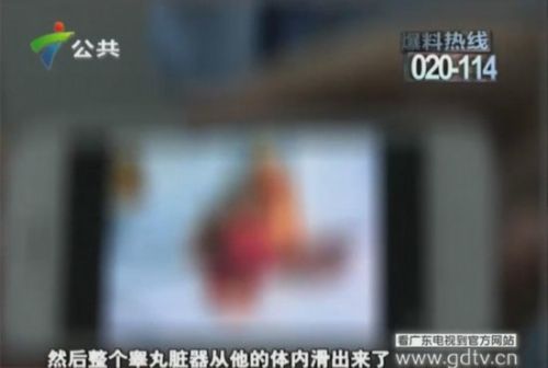 广州少年单车刹车失灵撞树睾丸意外飞出(图)(6)