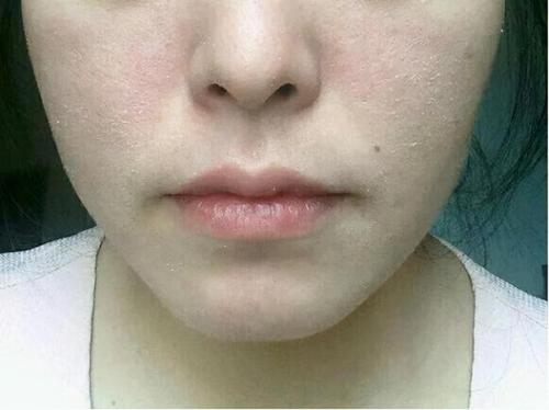 女公关首次公开自己感染艾滋病经历,希望给女孩们提个醒