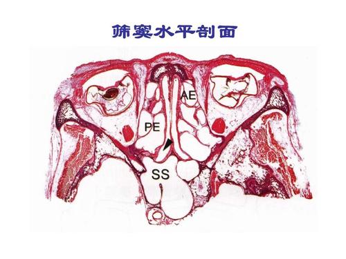 鼻部解剖 筛窦水平剖面