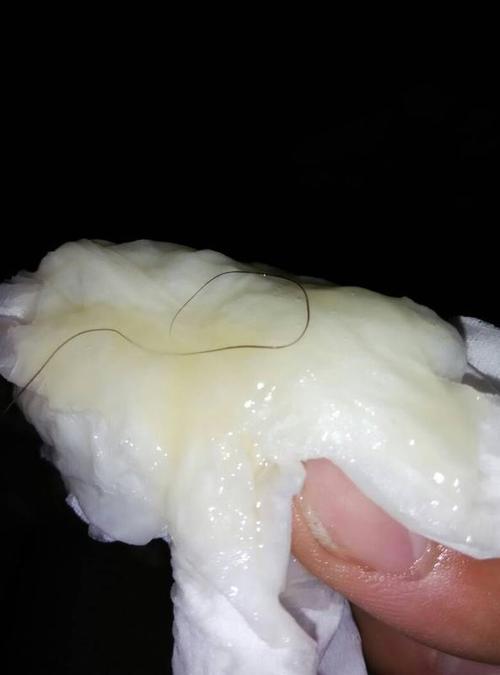 请问我射的这个精子颜色正常吗,还有一股腥味