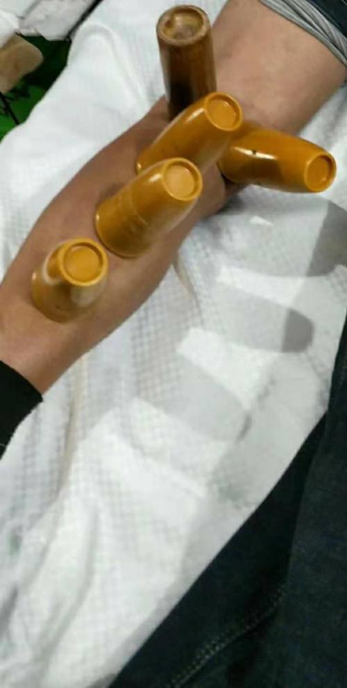 中医按摩技术培训与纯野生植物配方调理敷贴技术培训联合招生