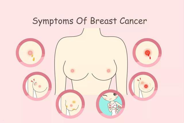 乳房早期诊断很重要!