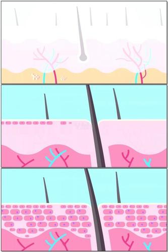 皮肤皮层毛孔机理