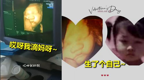 准爸爸看四维照吐槽宝宝脸大准妈妈临产前做彩超想看孩子长啥样 爸爸