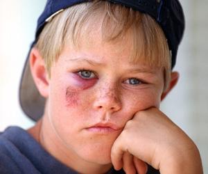 脸上有严重擦伤