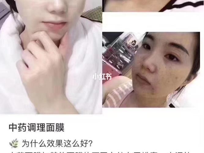 中药面膜_中药面膜_皮肤问题_免疫力_净化排毒_氧化_血液循环_代谢_亮