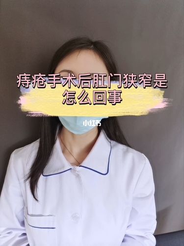 痔疮手术后肛门狭窄是怎么回事_痔疮_知识_科学科普