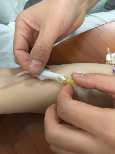 其它 留置针使用注意事项 写美篇其它一:留置3～4天,贴膜下异常渗出