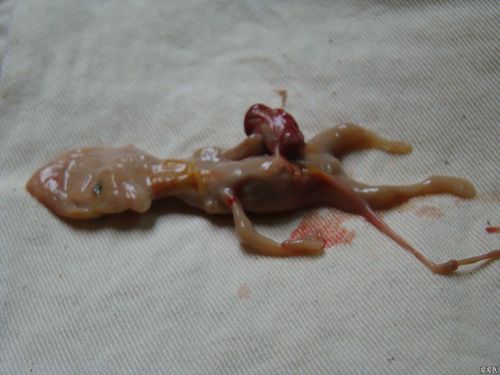 引产出类似干尸样死胎