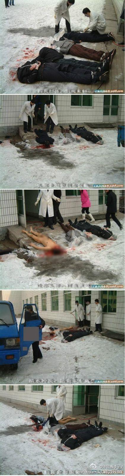 看看法医如何验尸