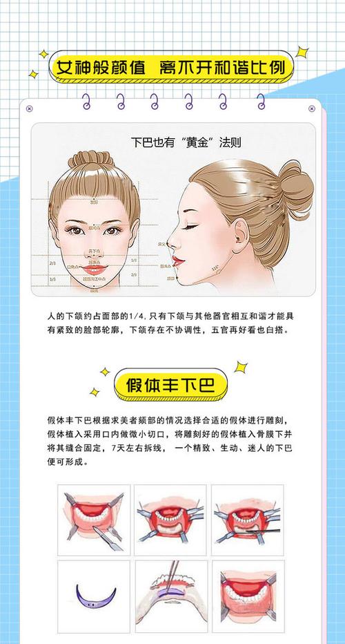 宜宾华仁立秀膨体假体下巴 假体隆下巴 膨体精雕技术 适合下巴后缩