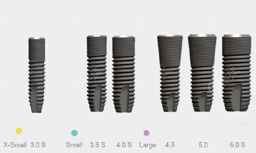 astra种植体价格多少钱一颗还想知道它是哪国的及其使用寿命