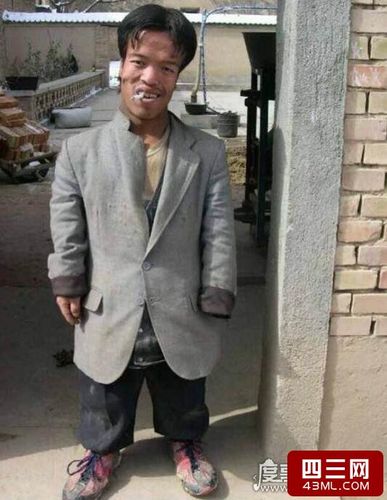 最令人呕吐的丑男照片,他被称为sebabi意为"最丑的乌干达人"