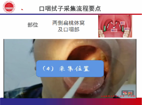 采集口咽拭子,鼻咽拭子.