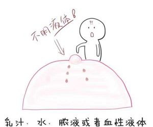 乳头溢液的异常颜色
