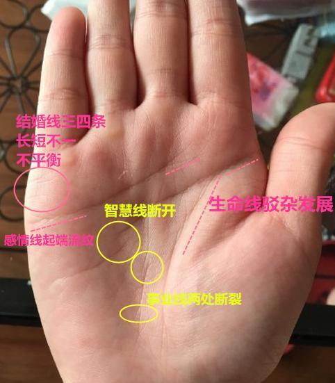 若手相感情线出现链条纹,必为感情烦恼,若结婚,婚姻有家庭风波