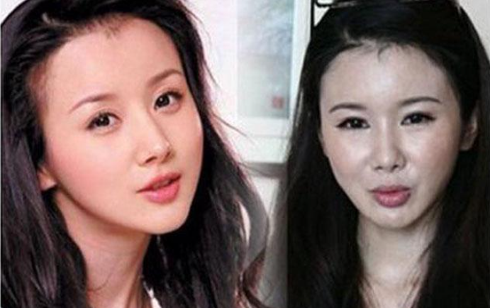 盘点娱乐圈整容失败的女明星,有的整的像僵尸,最后一个可惜了