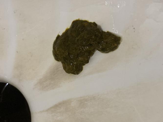 这个是粘液便吗?正常吗