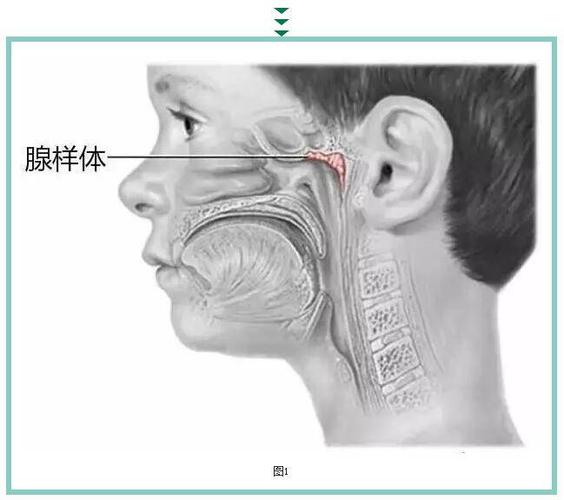 腺样体肥大一定会影响面容吗?腺样体肥大是什么原因造成的?