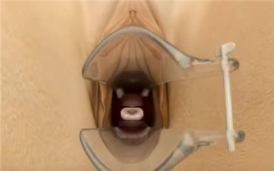 上环一个月了,可以长时间坐吗?