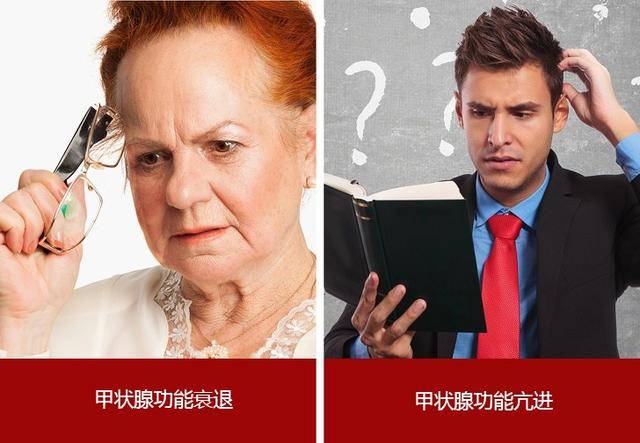 甲状腺异常的9大特征我是双下巴你是哪一种
