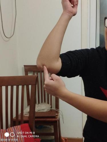 胳膊肘外侧,靠身体部位的疼痛