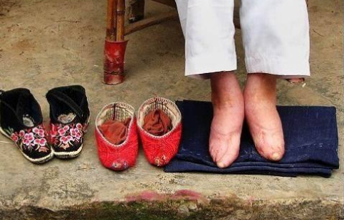 古代男子为何对"三寸金莲"情有独钟?
