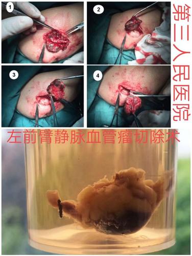 曲阜市第三人民医院(尼山中心卫生院)外科