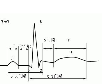 原创普通人怎么看心电图?医生说:把图上的线条和心脏的跳动结合起来