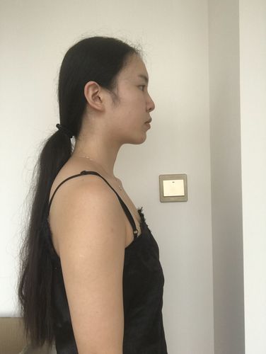 但心里还是有一点介意,觉得女人味不够,想找个方法彻底改变一下平胸