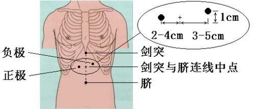 *怎么找到剑突:顺胸部的正中向下摸,一直摸到最下有一尖尖的硬骨头就