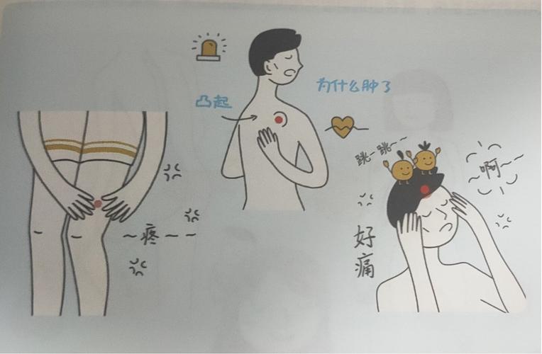 软组织肉瘤有什么症状?