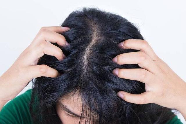 头皮发痒一抓发现有疙瘩是头皮生病了吗要注意什么