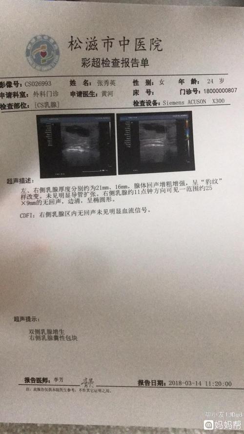 请问各位妈妈们,我这个乳腺囊肿需要手术吗?