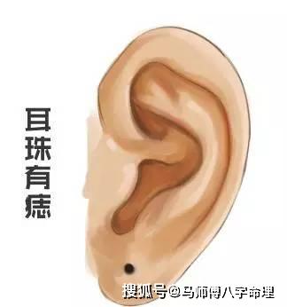 一,耳珠有痣