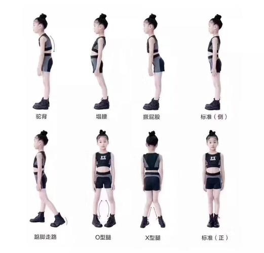 先天性或后天形成的不良体态