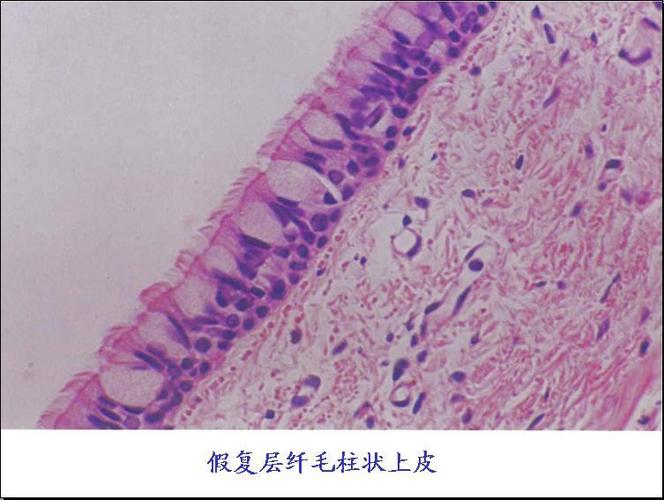 假复层纤毛柱状上皮