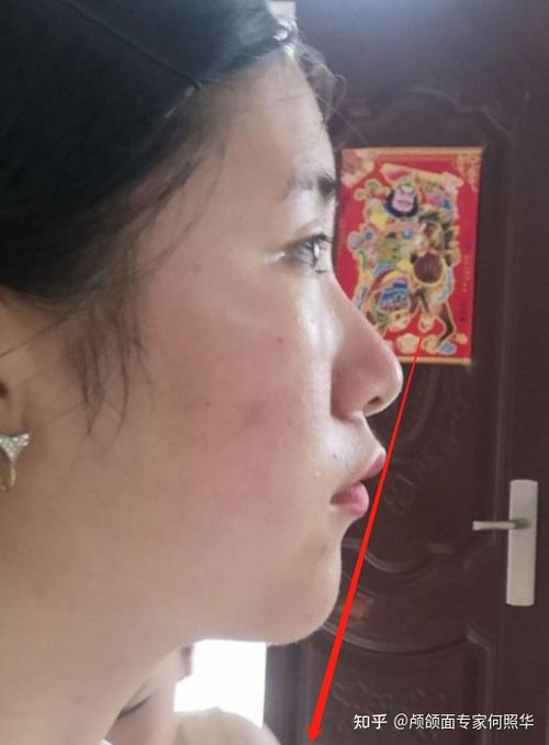 侧脸很宽是什么原因