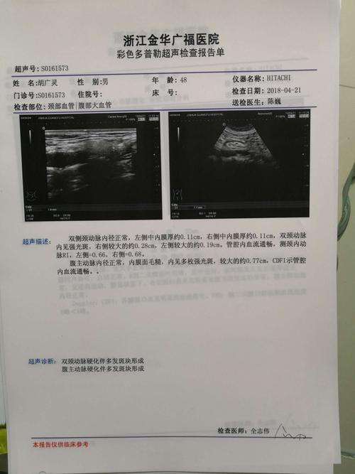 双颈,腹动脉b超