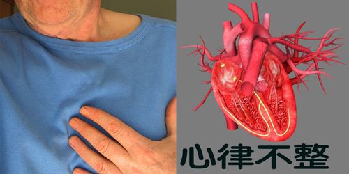 正常人的心律是由右心房的窦房结启动让心室收缩,造成心脏跳动,但如果