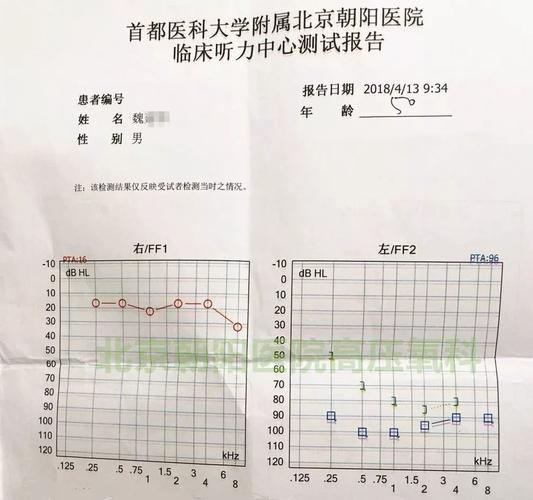 这位10天听力提高72分贝的患者,他是怎么治疗的?