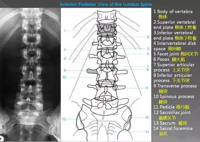 详细的腰椎x线解剖 解读|关节|弓根|曲度|椎体_网易