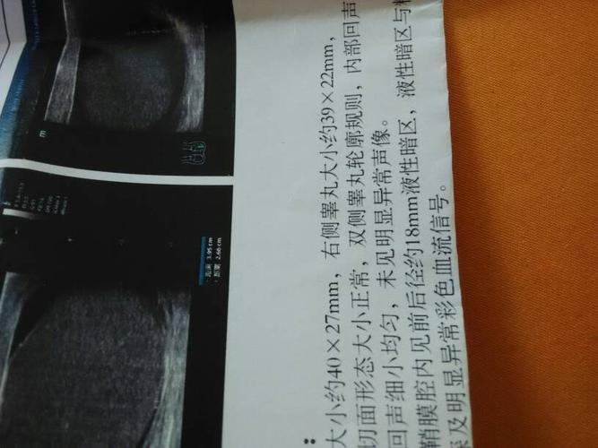 请问睾丸大小多少算正常,请大家帮我看看,谢谢了.