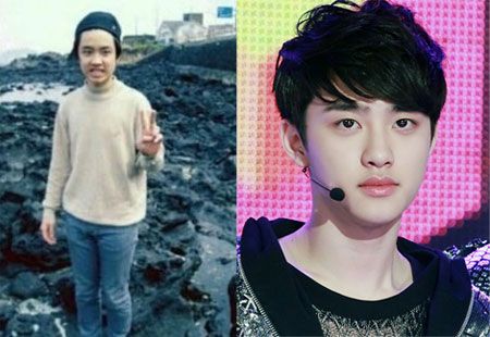 都暻秀整容前后对比照疑流出_读书人