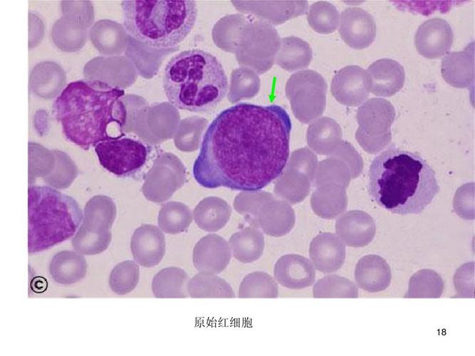 原始红细胞 18