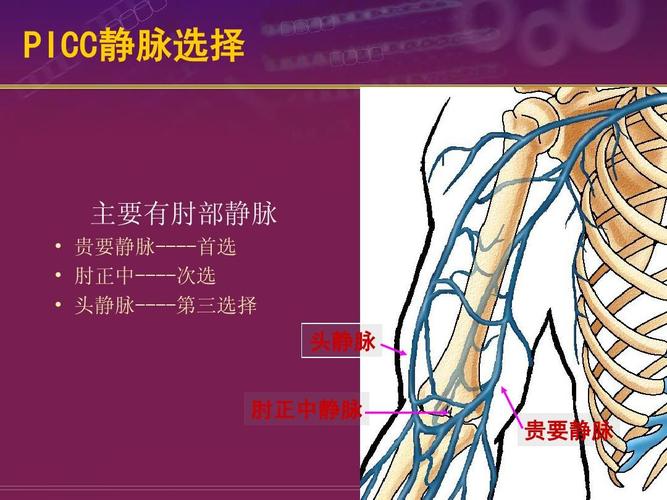 关于picc的护理事项 picc静脉选择 主要有肘部静脉   贵要静脉