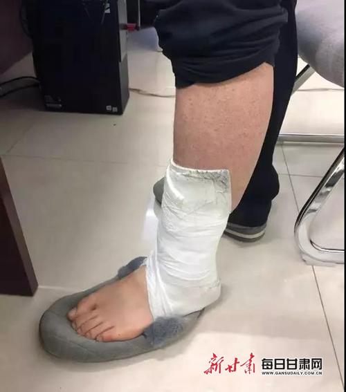 张文才未痊愈的左脚脚踝还绑着夹板绷带
