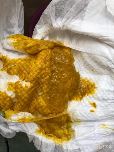 宝宝一天拉三次这种便便正常吗?是不是拉稀