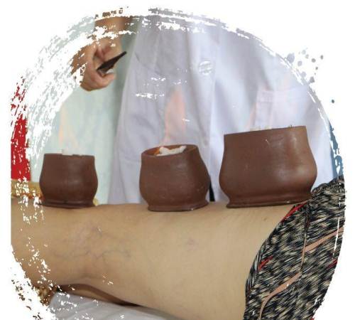 天下第一罐 巨罐(火罐)现面向全国招商!0加盟费