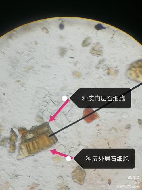 五味子显微特征